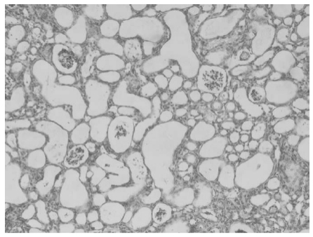 Series Introduction to Active Folate Impurities: ① Unveiling the Impact of 5-Methyltetrahydropteroic acid.